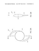 MASKED INTRAOCULAR IMPLANTS AND LENSES diagram and image