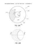 MASKED INTRAOCULAR IMPLANTS AND LENSES diagram and image