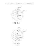 MASKED INTRAOCULAR IMPLANTS AND LENSES diagram and image