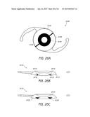 MASKED INTRAOCULAR IMPLANTS AND LENSES diagram and image