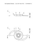 MASKED INTRAOCULAR IMPLANTS AND LENSES diagram and image