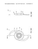 MASKED INTRAOCULAR IMPLANTS AND LENSES diagram and image