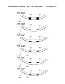 MASKED INTRAOCULAR IMPLANTS AND LENSES diagram and image