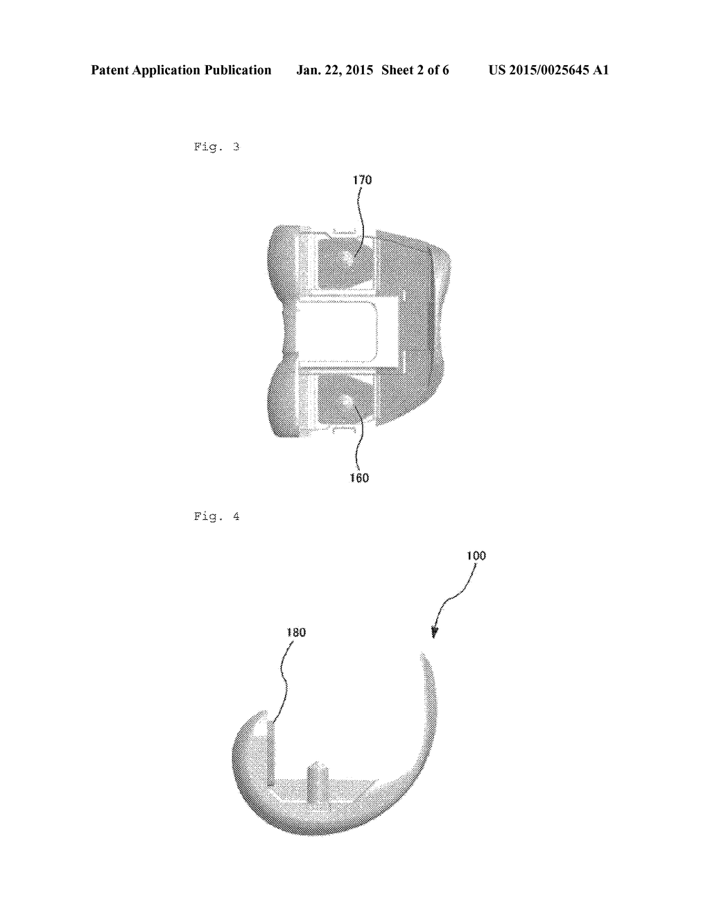 ARTIFICIAL KNEE JOINT - diagram, schematic, and image 03