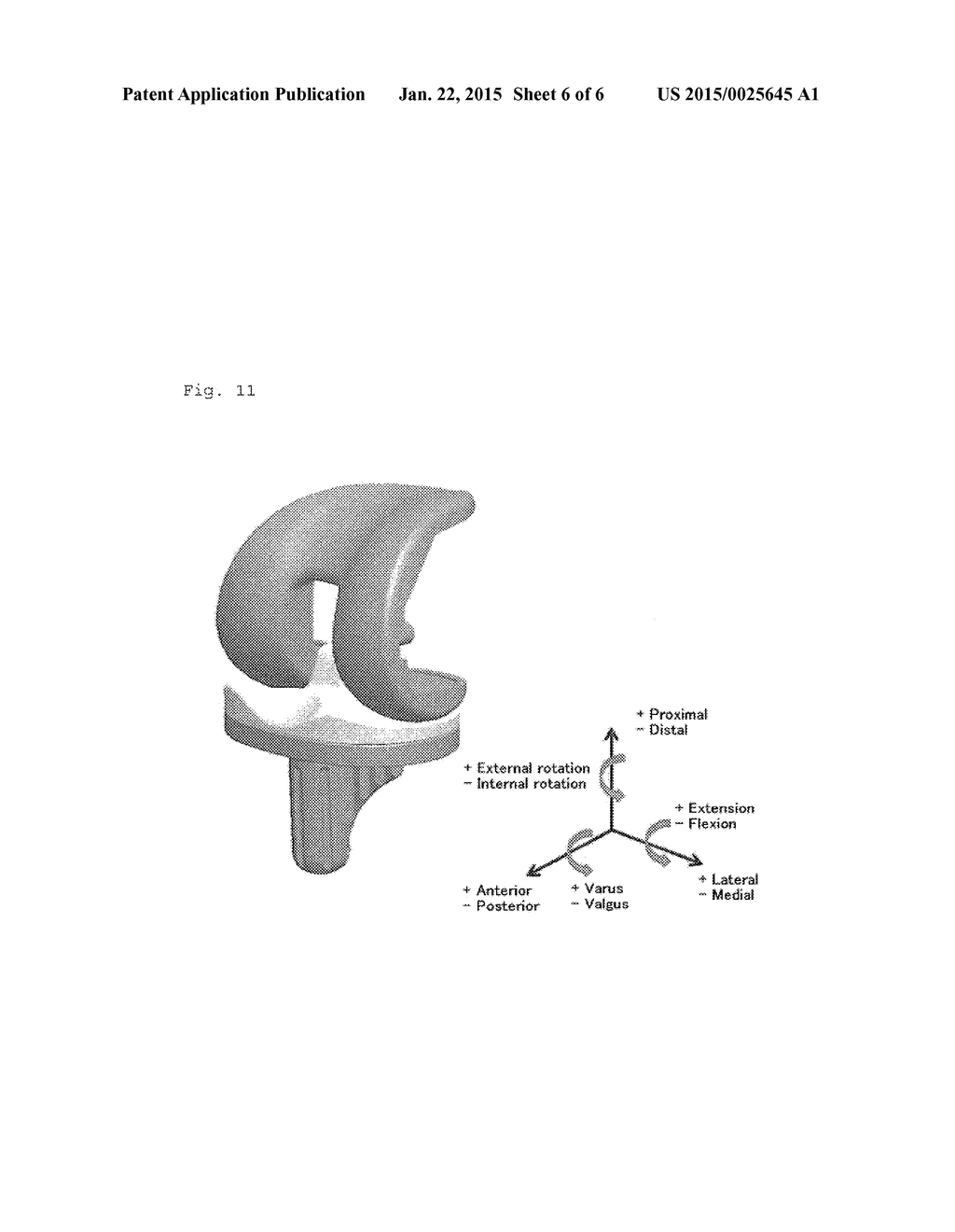 ARTIFICIAL KNEE JOINT - diagram, schematic, and image 07