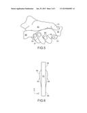 Handle of Knife diagram and image