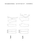 PATTERNING SYSTEM FOR SELECTED BODY TYPES AND ARTICLES OF MANUFACTURE     PRODUCED THEREFROM diagram and image