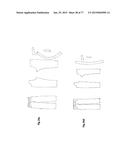 PATTERNING SYSTEM FOR SELECTED BODY TYPES AND ARTICLES OF MANUFACTURE     PRODUCED THEREFROM diagram and image