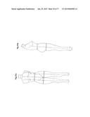 PATTERNING SYSTEM FOR SELECTED BODY TYPES AND ARTICLES OF MANUFACTURE     PRODUCED THEREFROM diagram and image