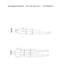 PATTERNING SYSTEM FOR SELECTED BODY TYPES AND ARTICLES OF MANUFACTURE     PRODUCED THEREFROM diagram and image