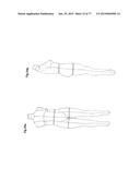 PATTERNING SYSTEM FOR SELECTED BODY TYPES AND ARTICLES OF MANUFACTURE     PRODUCED THEREFROM diagram and image