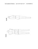 PATTERNING SYSTEM FOR SELECTED BODY TYPES AND ARTICLES OF MANUFACTURE     PRODUCED THEREFROM diagram and image