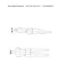 PATTERNING SYSTEM FOR SELECTED BODY TYPES AND ARTICLES OF MANUFACTURE     PRODUCED THEREFROM diagram and image