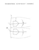 PATTERNING SYSTEM FOR SELECTED BODY TYPES AND ARTICLES OF MANUFACTURE     PRODUCED THEREFROM diagram and image