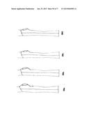 PATTERNING SYSTEM FOR SELECTED BODY TYPES AND ARTICLES OF MANUFACTURE     PRODUCED THEREFROM diagram and image