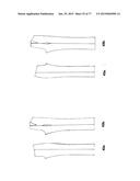 PATTERNING SYSTEM FOR SELECTED BODY TYPES AND ARTICLES OF MANUFACTURE     PRODUCED THEREFROM diagram and image