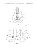 DECORATIVE GUITAR TAILPIECE COVER diagram and image