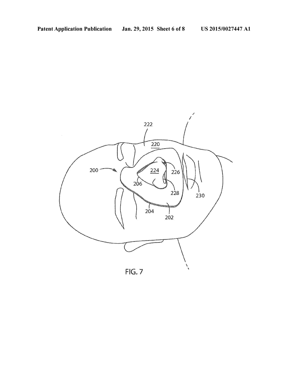 RESPIRATION MASK INTERFACE SEAL - diagram, schematic, and image 07