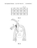 HAIR VOLUMIZING DEVICE THAT UTILIZES INDIVIDUAL TREATMENT ELEMENTS WITHOUT     LEAVING A VISIBLE PATTERN diagram and image