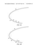 LEAD ASSEMBLY WITH POROUS POLYETHYLENE COVER diagram and image