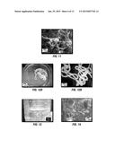 METHODS OF TREATMENT OF A SUBTERRANEAN FORMATION WITH POLYMERIC STRUCTURES     FORMED IN SITU diagram and image