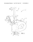 Removable Chain Attachment Insert diagram and image