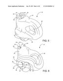 Removable Chain Attachment Insert diagram and image