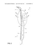 SHORT OFFSET SHEET METAL REINFORCEMENT TO LIMIT ROTATION DURING CRASH diagram and image