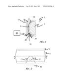 Method For Creating A Viewing Screen Having An Injection Overmolded Insert diagram and image