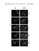 METHOD OF BLOCKING VASCULAR LEAKAGE USING AN ANTI-ANG2 ANTIBODY diagram and image