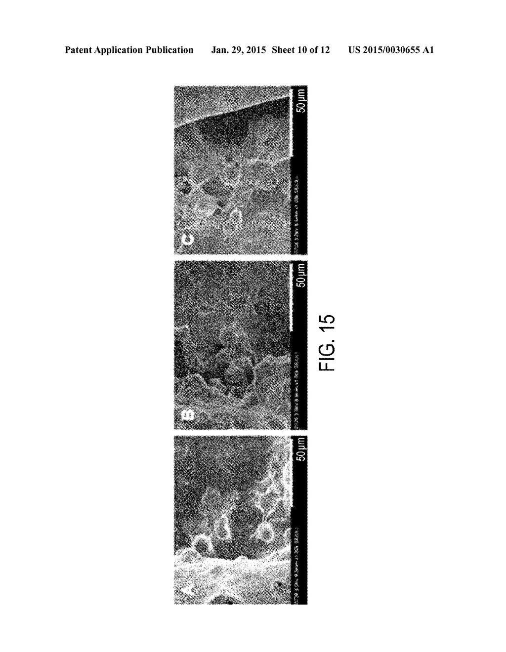 PLGA SCAFFOLD - diagram, schematic, and image 11