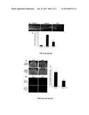 COMPOSITIONS COMPRISING EXTRACTS OR MATERIALS DERIVED FROM PALM OIL     VEGETATION LIQUOR FOR INHIBITION OF VISION LOSS DUE TO ANGIOGENESIS AND     METHOD OF PREPARATION THERE diagram and image