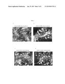 TREATMENT OF BRAIN DERIVED NEUROTROPHIC FACTOR (BDNF) RELATED DISEASES BY     INHIBITION OF NATURAL ANTISENSE TRANSCRIPT TO BDNF diagram and image