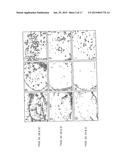 METHOD OF PREVENTING, TREATING AND DIAGNOSING DISORDERS OF PROTEIN     AGGREGATION diagram and image