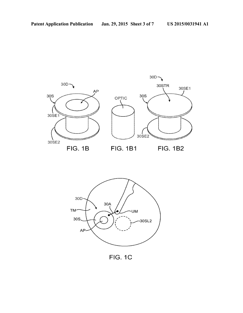 Eardrum Implantable Devices for Hearing Systems and Methods - diagram, schematic, and image 04