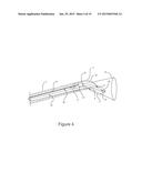 DIRECT VISION CRYOSURGICAL PROBE AND METHODS OF USE diagram and image