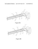 DIRECT VISION CRYOSURGICAL PROBE AND METHODS OF USE diagram and image