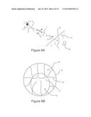 DIRECT VISION CRYOSURGICAL PROBE AND METHODS OF USE diagram and image