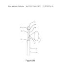 DIRECT VISION CRYOSURGICAL PROBE AND METHODS OF USE diagram and image