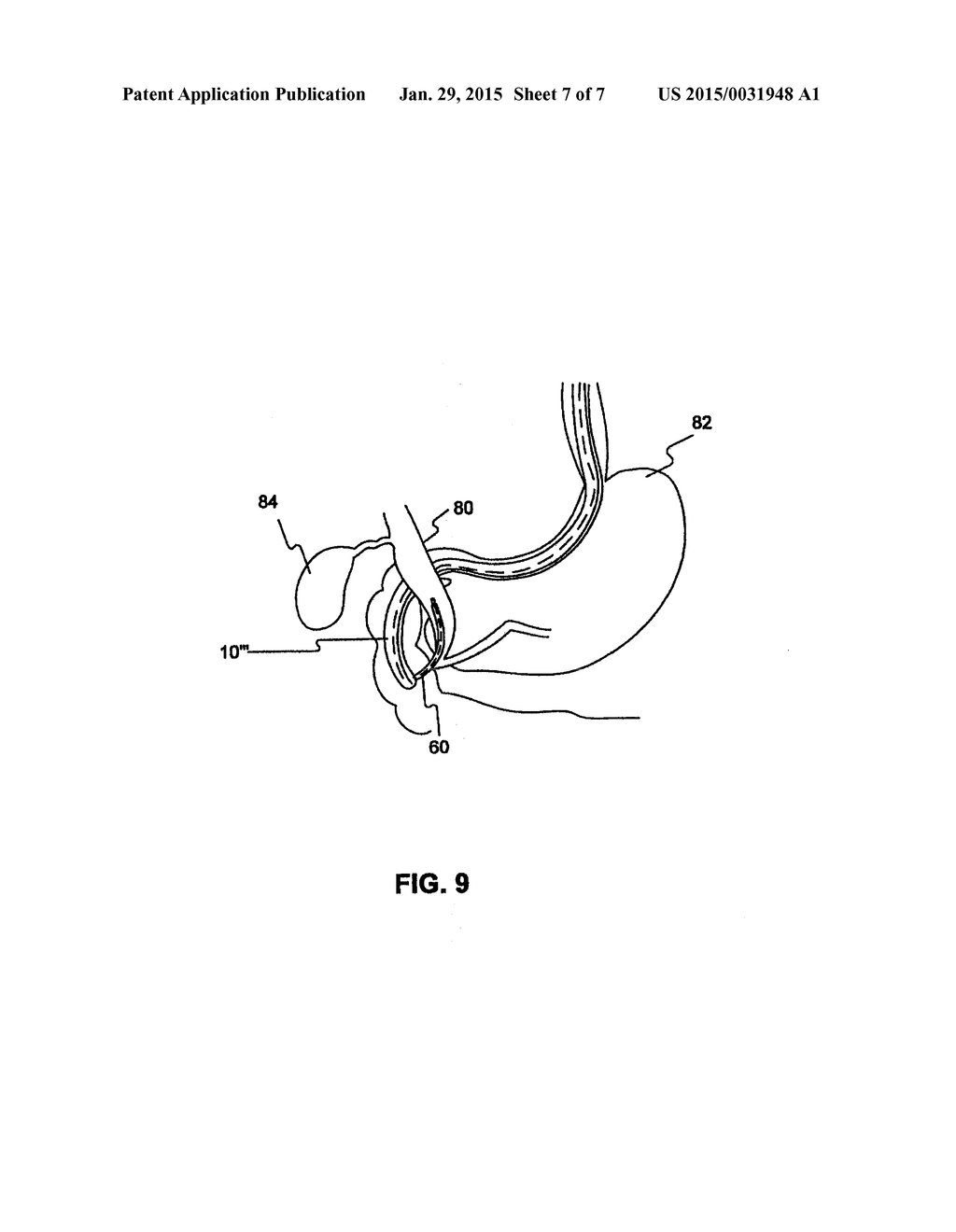 MEDICAL DEVICE POSITIONING SYSTEM - diagram, schematic, and image 08