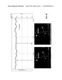 EVALUTATING CARDIOVASCULAR HEALTH USING INTRAVASCULAR VOLUME diagram and image