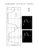 EVALUTATING CARDIOVASCULAR HEALTH USING INTRAVASCULAR VOLUME diagram and image