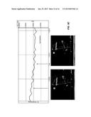 EVALUTATING CARDIOVASCULAR HEALTH USING INTRAVASCULAR VOLUME diagram and image