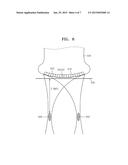 ULTRASOUND DIAGNOSTIC METHOD AND APPARATUS USING SHEAR WAVES diagram and image