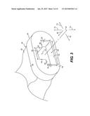 DISPOSABLE SHEATH diagram and image