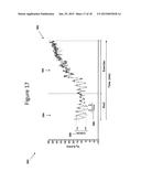 PATTERN RECOGNITION SYSTEM FOR QUANTIFYING THE LIKELIHOOD OF THE     CONTRIBUTION OF MULTIPLE POSSIBLE FORMS OF CHRONIC DISEASE TO PATIENT     REPORTED DYSPNEA diagram and image