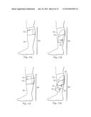 COMPRESSION SLEEVE AUGMENTING CALF MUSCLE PUMP diagram and image