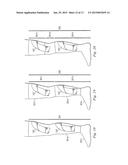 COMPRESSION SLEEVE AUGMENTING CALF MUSCLE PUMP diagram and image