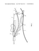 CATHETER ACCESS AND CONTROL DEVICE AND METHOD OF USING SAME diagram and image