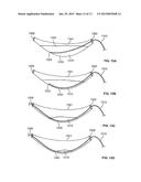 CATHETER ACCESS AND CONTROL DEVICE AND METHOD OF USING SAME diagram and image